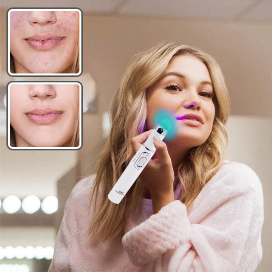 Stylo laser anti imperfections 3 en 1 @glowaffinity.com