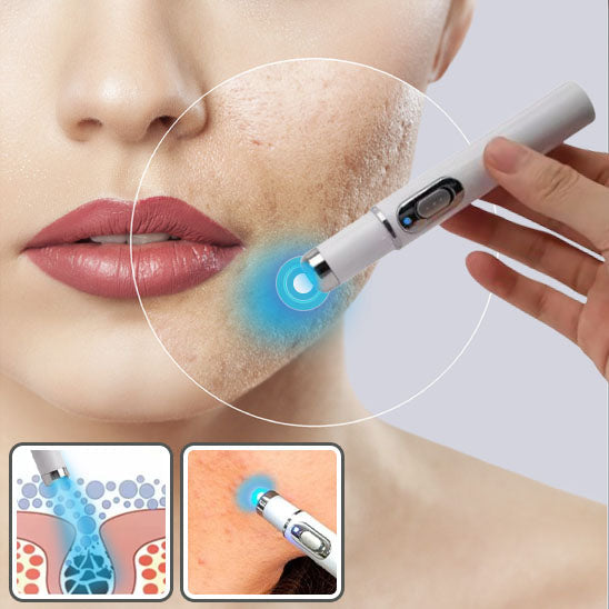 Stylo laser anti imperfections 3 en 1 @glowaffinity.com